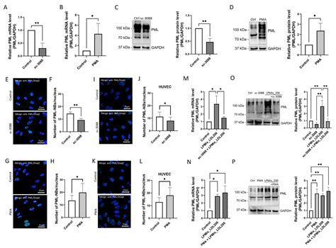 Ijms Free Full Text Ldl Affects The Immunomodulatory Response Of