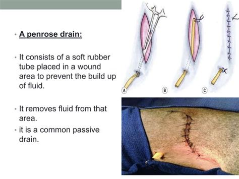 Drains Tubes Used In Surgery Pptx