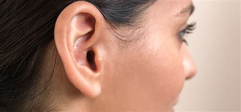 Earlobe Repair Mclean And Potomac Dermatology