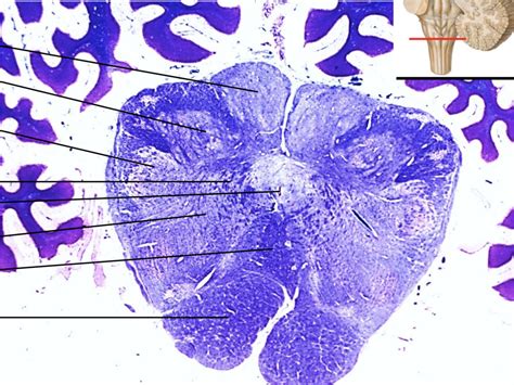 ANAT 2160 Caudal Medulla At Level Of Sensory Decussation Diagram Quizlet