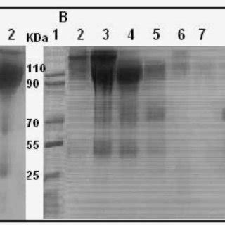 Of Non Reducing Sds Page Analysis Of Ammonium Sulfate Fractionated