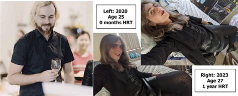 Mtf 1 Year Hrt R Transtimelines