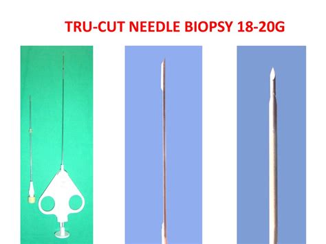 Research On Diagnosis Of Lung Cancer With Percutaneous Transthoracic Needle Biopsy Under Ct Scan