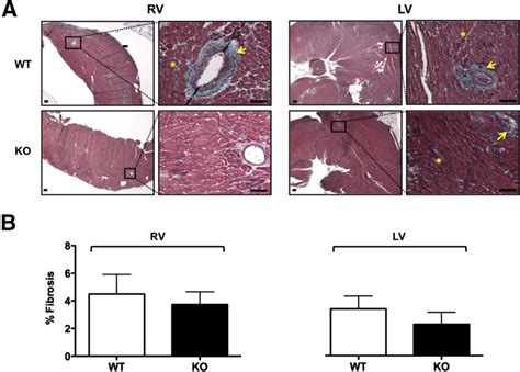 Both Wt And Trpc Ko Rats Exhibited Cardiac Fibrosis After Su Hx Nx