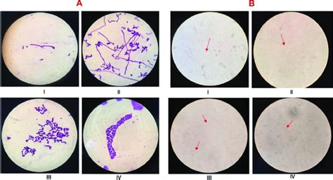 A Stained B Unstained Formation Of Germ Tube In Untreated Cells Download Scientific