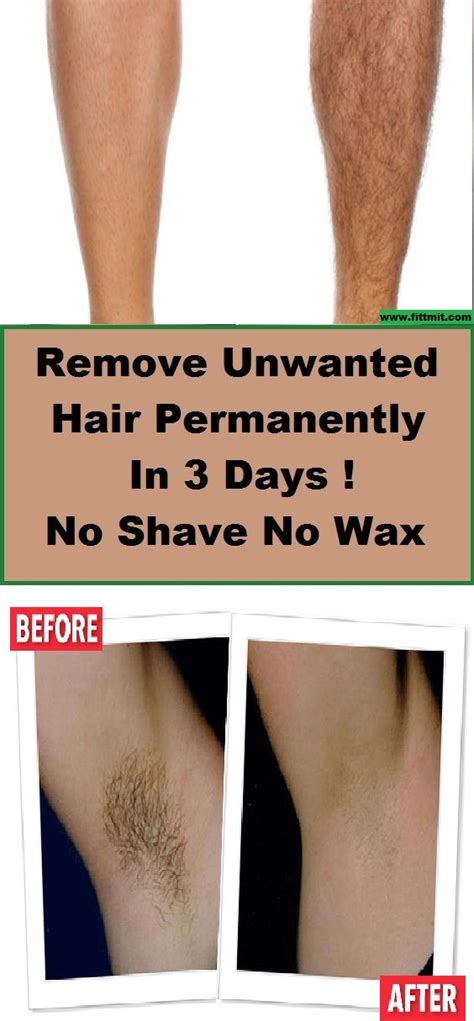 How To Remove Unwanted Body Hair Permanently At Home Unwanted Hair