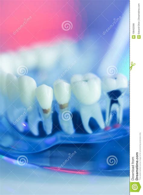 Dental Teeth Dentist Model Stock Photo Image Of Model 106452588