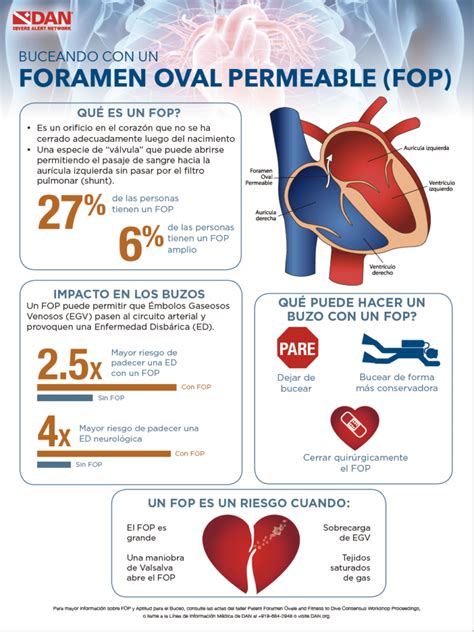 Directrices Para El Foramen Oval Permeable Y La Forma F Sica Dan World