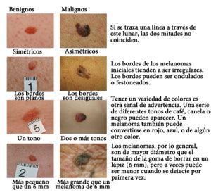 Como Diferenciar Un Lunar De Un Melanoma Melanoma Latinoamerica