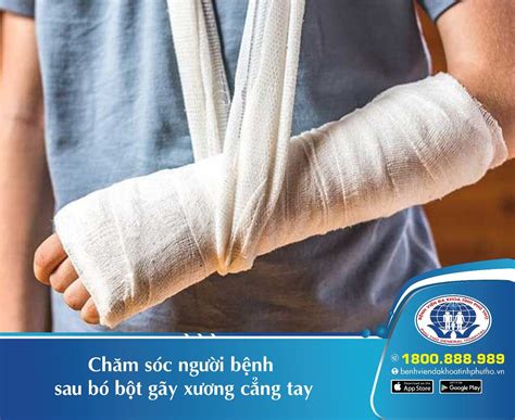 Tìm hiểu về quy trình chăm sóc bệnh nhân gãy xương cẳng tay ở Hà Nội