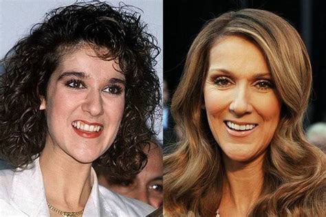 17 best celebrity teeth before and after images on Pinterest | Famous ...