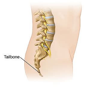 Tailbone (Coccyx) Fracture - Sterling Care - In-Home Care Westchester ...