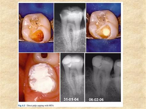 Using www mta information and what the alerts signify 27