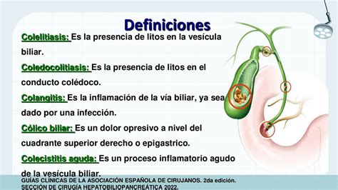 Definiciones De Patolog As Biliares Medicina Con Sebas Udocz