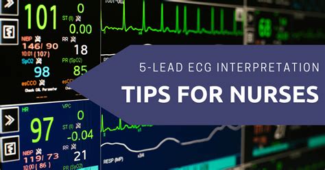 5 Lead Ecg Interpretation Electrocardiogram Tips For Nurses Freshrn