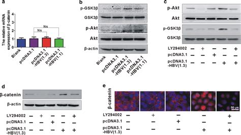 Aktgsk3β Signaling Is Responsible For Elevated β Catenin Expression In