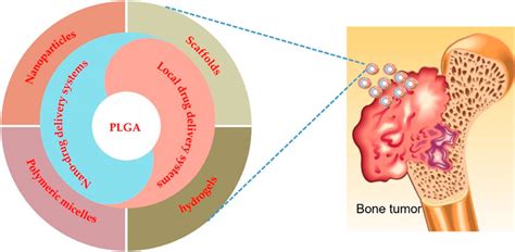 Frontiers Plga Based Drug Delivery Systems In Treating Bone Tumors