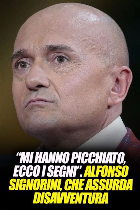 Mi Hanno Picchiato Ecco I Segni Alfonso Signorini Che Assurda