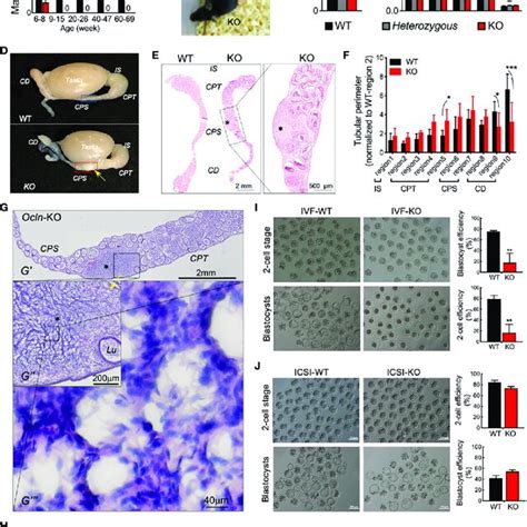 Dysfunction Epididymal Function Rather Than Testicular Spermatogenesis