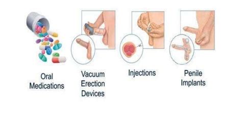 Sexual Rehabilitation Ppt