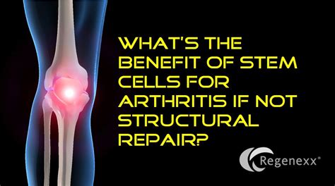 What S The Benefit Of Stem Cells For Arthritis If Not Structural Repair