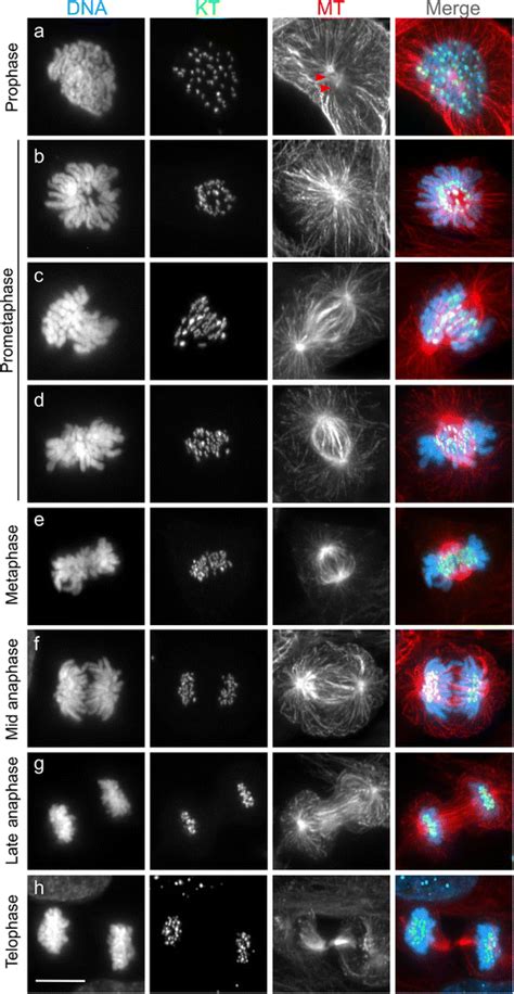 A Guide To Classifying Mitotic Stages And Mitotic Defects In Fixed