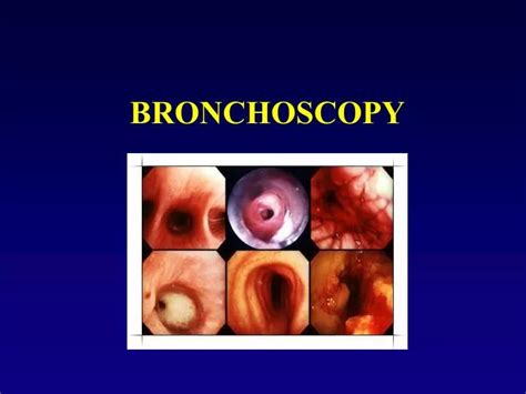 Ppt Bronchoscopy Powerpoint Presentation Free Download Id5317592