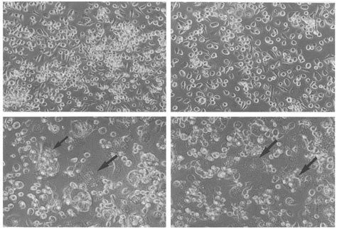 Phase Contrast Micrographs To Illustrate The Morphological Effects Of