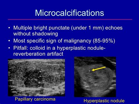 Pin on thyroide