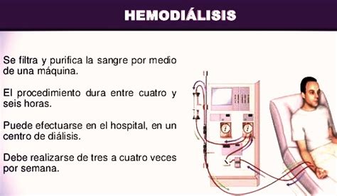 Qu Es Una Hemodi Lisis Vivir Mejor