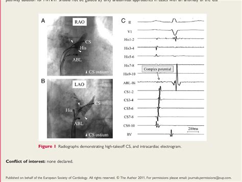 Figure From The Electroanatomical Remodelling Of The Left Atrium Is