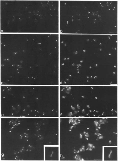 Double Label Immunofluorescence Of Spheroplasts Labeled With Mabs Download Scientific Diagram