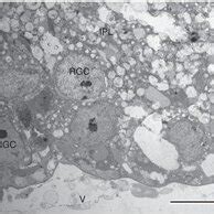 Apoptosis Immunofluorescence Of Cleaved Caspase And Thy In