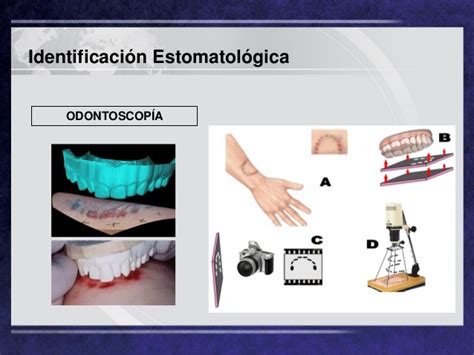 Odontolog A Forense