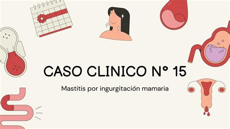 CASO CLINICO Mastitis por ingurgitación mamaria Lupita uDocz