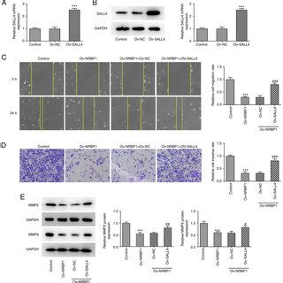 Overexpression Of Nrbp Inhibits The Invasion And Migration Of Bc