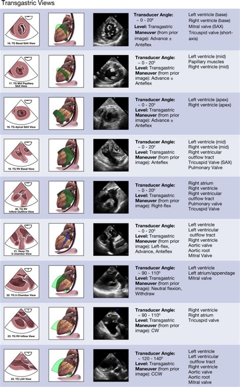 Guidelines For Performing A Comprehensive Transesophageal