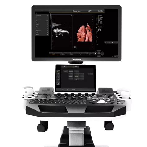 High Quality Color Doppler D D D Ultrasound Trolley Gynecology