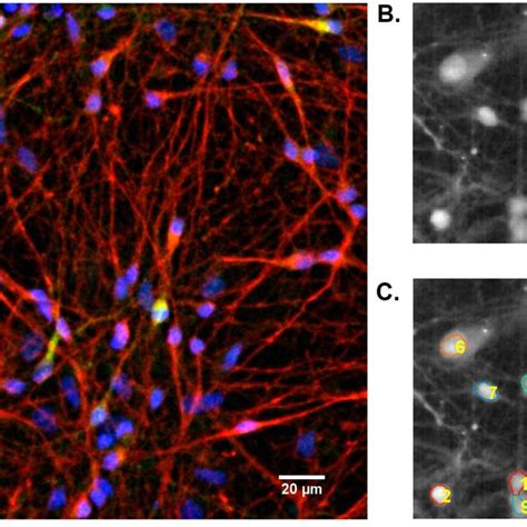 Immunostaining And Calcium Imaging Immunostaining Of Differentiated