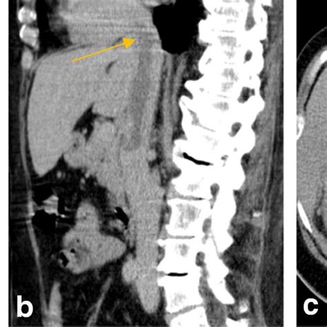 Preoperative Computed Tomographymagnetic Resonance Imaging Of The