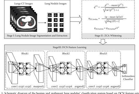 Figure 1 From Classification Of Benign And Malignant Lung Nodules Based On Deep Convolutional