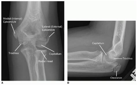 Ossification Centers Elbow