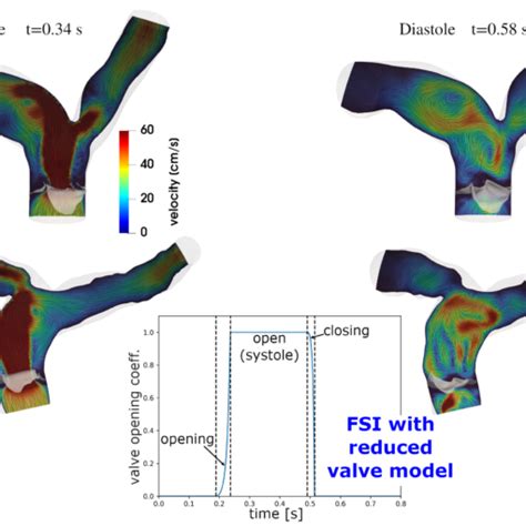 New MOX Report On Computational Haemodynamics For Pulmonary Valve