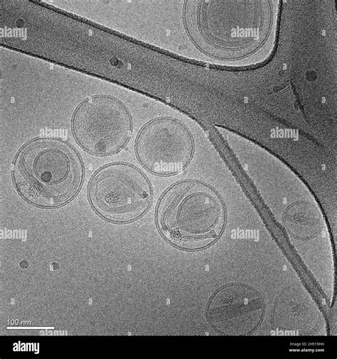 Imagen Electr Nica De Nanopart Culas Hechas De L Pidos Que Contienen Un