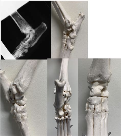 Diagram Of Anatomical Features Of The Tarsus Quizlet