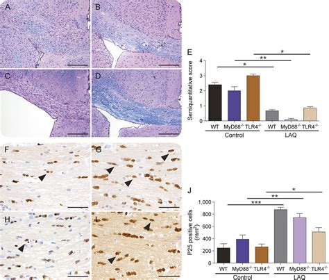 Laquinimod Prevents Cuprizone Induced Demyelination Independent Of Toll