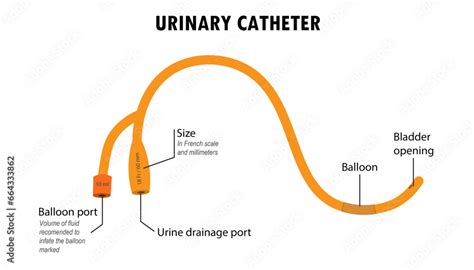 Urinary Catheter Diagram How It Is Used Instructions Stock Vektorgrafik Adobe Stock