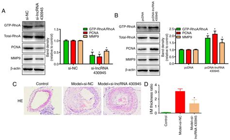 LncRNA 430945 Promotes The Proliferation And Migration Of Vascular