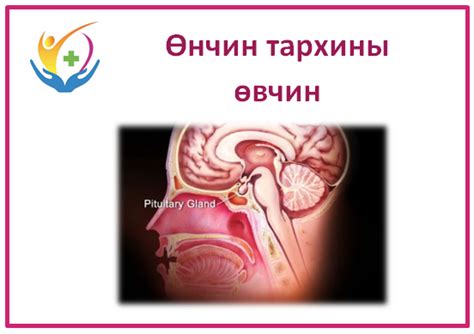 Өнчин тархины өвчнүүд: Хүний дотор... - Гэгээн Ар Үр Эмнэлэг