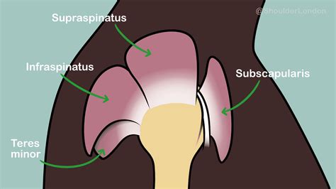 Rotator Cuff Repair Protocol 2020 Amerson Kishaba